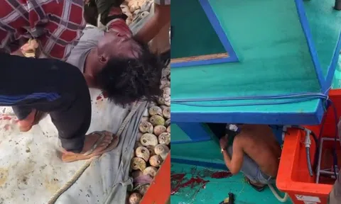 Cà Mau: Nổ ghe biển làm 3 người bị bỏng nặng